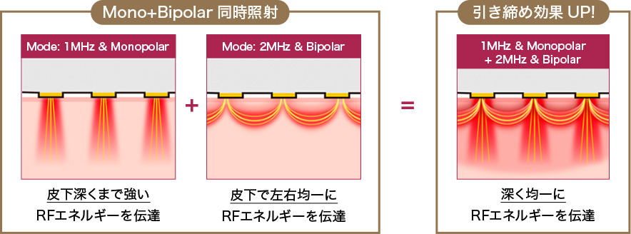 Mono+Bipolar 同時照射、Mode: 1MHz & Monopolar、皮下深くまで強いRFエネルギーを伝達 + Mode: 2MHz & Bipolar、皮下で左右均一にRFエネルギーを伝達 = 引き締め効果UP!、1MHz & Monopolar + 2MHz & Bipolar、深く均一にRFエネルギーを伝達